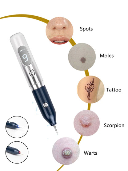 Stylo plasma laser – élimination taches, verrues, tatouages, soins visage
