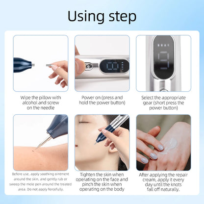 Stylo plasma laser – élimination taches, verrues, tatouages, soins visage