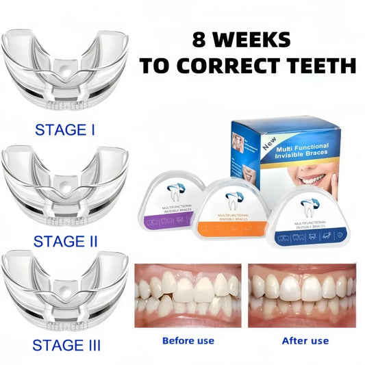 protège-dents orthodontique, entraîneur dentaire, confortable, ajustement rapide .